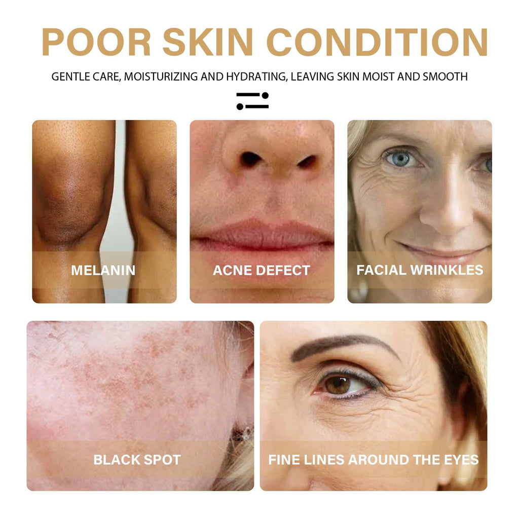 VOYDX TURMERIC DARK SPOT CORRECTING SERUM